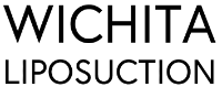 Business Listing Wichita Liposuction in Wichita KS