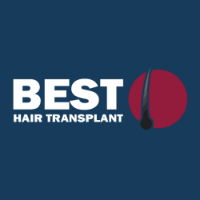 Business Listing Best Hair Transplant in Redondo Beach CA