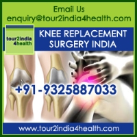 Best Knee Replacement Surgery in India